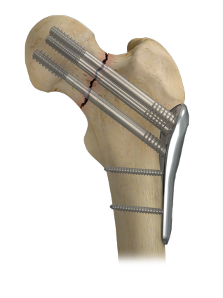 CONQUEST FN Hero 2.png