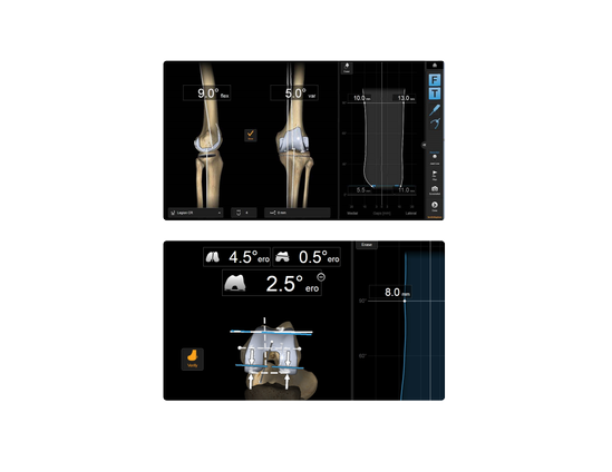 RI.KNEE Navigation Hero 2.png