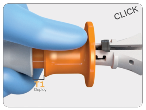 Increase reliability-FFF.png