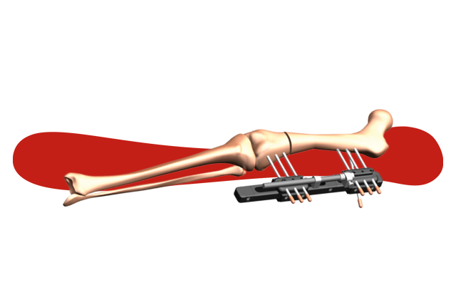 MODULAR RAIL Matisse